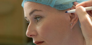 Understanding post-operative instruction after undergoing facelift surgery