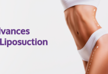 What Are the Latest Advances in Liposuction