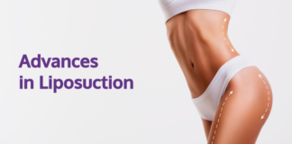 What Are the Latest Advances in Liposuction