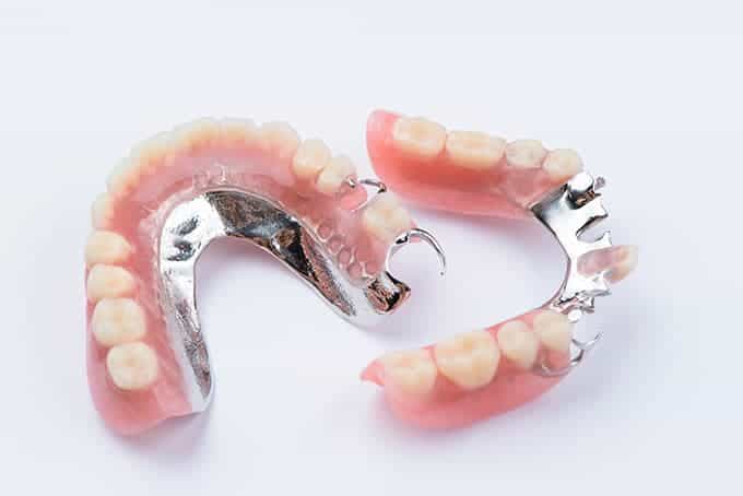 What Type of Repairs can be Carried out on Removable Partial Dentures