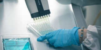 What is the most commonly used Elisa test?