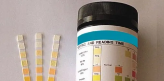 Is there an app to read urine test strips?