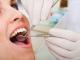 Seven Imperatives Reasons for Regular Dental Checkups